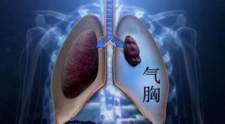 bfc736530beb620d8f9fc203ce9795b0.png