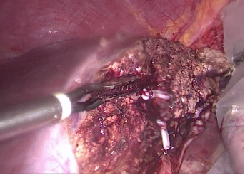 图片.png 图片.png